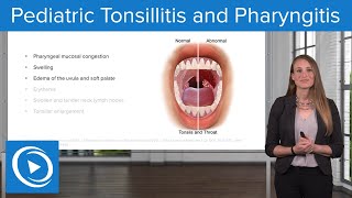 Pediatric Tonsillitis and Pharyngitis – Pediatric Nursing  Lecturio [upl. by Mlawsky885]