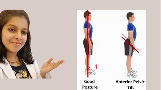 Anterior Pelvic Tilt [upl. by Ahterahs]