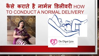 NORMAL DELIVERY कैसे कराते है नार्मल डिलीवरीHindi [upl. by Temhem]