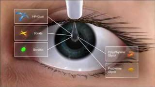 Alcon Dry Eye Video and Systane Ultra Action [upl. by Nospmis]