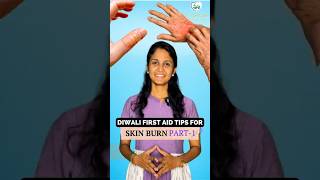 Diwali First Aid Tips For Skin Burn  Must Watch [upl. by Kalina]