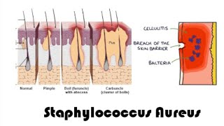 Staphylococcus aureus  complete overview  microbiology [upl. by Alastair]