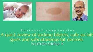 Sucking blisters cafe au lait spots and subcutaneous fat necrosis Dr Sridhar K [upl. by Mcquade]