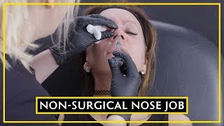 All About Using Dermal Fillers In The Nose [upl. by Aliuqehs]