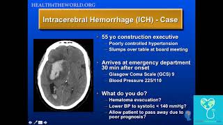 Intracerebral Hemorrhage Case Study  Health4TheWorld Academy [upl. by Brose758]