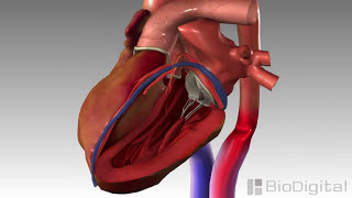 3D Medical Animation  Congestive Heart Failure [upl. by Giordano625]