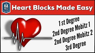 AV Heart Blocks Made Easy  1st 2nd 3rd Degree ECG Interpretation Explained [upl. by Carothers689]