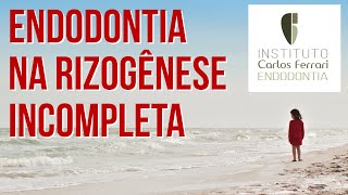 Endodontia na rizogênese incompleta  1a aula Conceitos básicos [upl. by Kcirdaed]