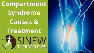 Compartment Syndrome Causes and Treatment [upl. by Nauqyt614]