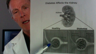 How to Test for Cardiovascular Inflammation Microalbumin Creatinine Ratio [upl. by Odracir884]