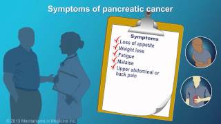 Pancreatic Cancer Signs Symptoms and Risk Factors [upl. by Eisaj]