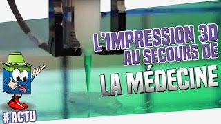 Impresssion 3D  La Nouvelle Solution Pour La médecine [upl. by Weiler]