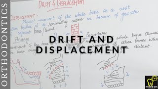 Drift and Displacement in OrthodonticsTypes of growth movements [upl. by Katheryn]