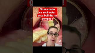 Essa bolinha na gengiva precisa da sua atenção gengiva dordedente dentista [upl. by Naasah]