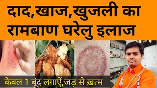 फंगल इन्फेक्शन का रामबाण इलाजFungal Inefction On Skin  Fungal Ki DawaFungus ka ilaj  Hindi [upl. by Kiyohara]