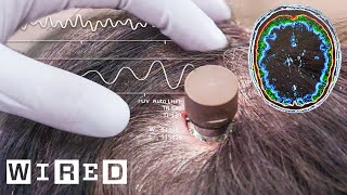 The Science Behind Elon Musk’s Neuralink Brain Chip  WIRED [upl. by Desiri]