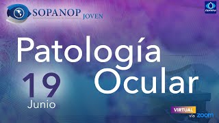 Patología Ocular [upl. by Trembly89]