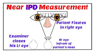 Near Inter Pupillary Distance Measurement [upl. by Mame108]