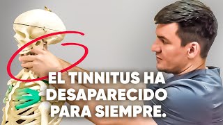 Las 3 principales causas del tinnitus ¡Hice esto y todo desapareció [upl. by Terti611]