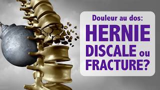 DOULEUR au DOS fracture ou hernie discale [upl. by Douty]