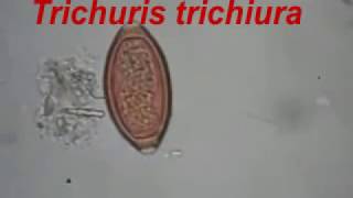 Trichuris trichiura and Ascaris lumbricoides [upl. by Prem]