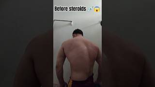 Steroids Side effects 😱 Dont use steroids ❌😭steroidssideeffects bodybuilding shortfeed viral [upl. by Nuriel]