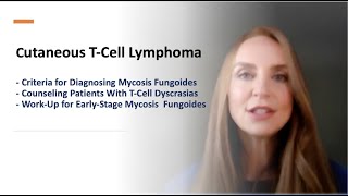 CTCL Criteria to Diagnose Counsel Patients and WorkUp for Earlystage Mycosis Fungoides [upl. by Enyal686]