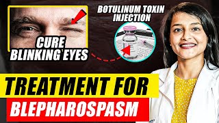 Blepharospasm and Botulinum Toxin Injections  Botulinum Toxin Mechanism of Action  Dr Rwituja [upl. by Lorianne]