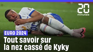 Euro 2024  Les images du nez cassé de Kylian Mbappé et tout savoir sur la suite [upl. by Baker]