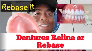 The Difference Between Denture Reline and Dentures Rebase [upl. by Clerk]