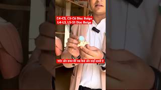 C4C5 C5C6 amp L4L5 L5S1 Disc Bulge  गर्दन और कमर की नस कैसे ओर कहाँ दबती है । Cervical Problem [upl. by Yhtomit]