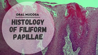 Histology of Specialized Mucosa  Filiform papillae [upl. by Dachia]