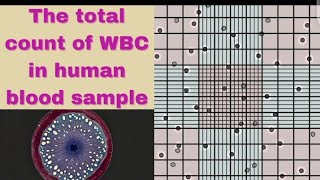 Experiment 🔬 The Total Count Of The WBC  leukocytes In Human Blood 🩸bsc 3rd year Life Science [upl. by Anec]