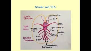 Stroke and TIA  CRASH Medical Review Series [upl. by Hartmann974]