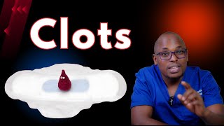 Understanding Menstrual Clots Causes amp Remedies  When to Worry [upl. by Airdnoed]