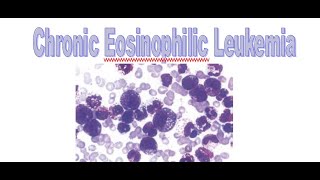 Chronic eosinophilic leukemia WHO 2022 [upl. by Ecahc]