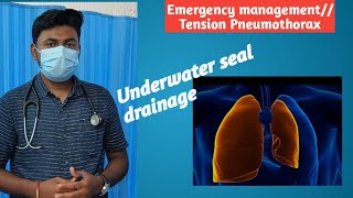 Tension Pneumothorax Emergency management [upl. by Daeriam752]