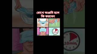 চোখে অঞ্জনি হলে কি করবেন stye treatement eyes health tips [upl. by Joel]