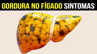 10 Sintomas de Gordura no Fígado CUIDADO COM ESSES SINAIS [upl. by Amadus848]