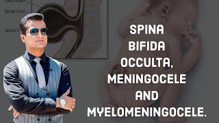 Spina Bifida occulta Meningocele and myelomeningocele [upl. by Talbert]