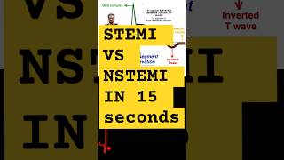 STEMI vs NSTEMiecg ST segment elevation vs ST segment depression stemi  cathlab [upl. by Jermayne]