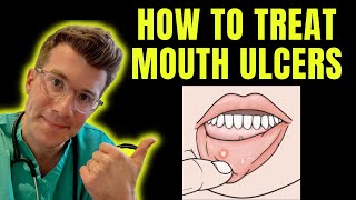 How to recognise and treat Mouth Ulcers getting rid of canker sores  Doctor ODonovan explains [upl. by Sessylu]