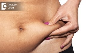 What are the complications of liposuction  Dr Sreekar Harinatha [upl. by Charters]