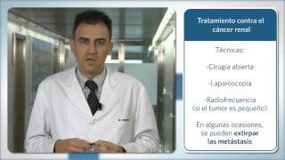 Últimos tratamientos para el cáncer de riñón [upl. by Roman]