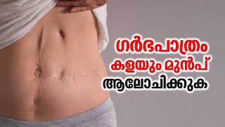 ഗർഭപാത്രം കളയും മുൻപ് ആലോചിക്കുക  Uterus Removal  Uterus Problem [upl. by Denis]