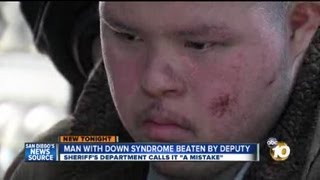 Man with Down Syndrome beaten by deputy San Diego Sheriffs Department calls it a mistake [upl. by Coyle]