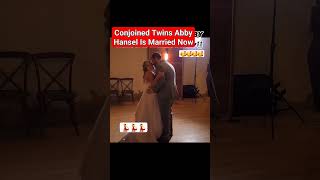 Abby Hensel One of the Conjoined Twins Gets Married viral abby trending [upl. by Adalbert515]