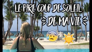 LE PIRE COUP DE SOLEIL DE MA VIE [upl. by Race]