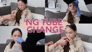 HAVING MY NG TUBE CHANGED  Tillies Journey [upl. by Eiser]