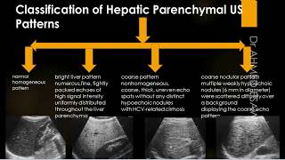 Liver Ultrasound Diffuse Disease Cirrhosis  fibrosis  Scoring  Hepatitis  Autoimmune  Contra [upl. by Housen]